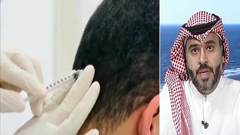 طبيب : السلوك الغذائي الخاطئ وقلة شرب الماء من مسببات الصداع (فيديو)