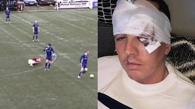 شاهد.. لاعب ينطح منافسه بوحشية خلال مباراة كرة قدم