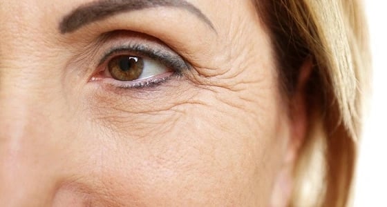 نصائح مذهلة للتخلص من تجاعيد الابتسامة