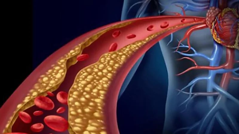 5 نصائح لخفض معدلات الكوليسترول بالجسم