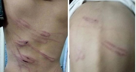 الشرطة تلقي القبض على أب يعتدي على أبنائه بالباحة