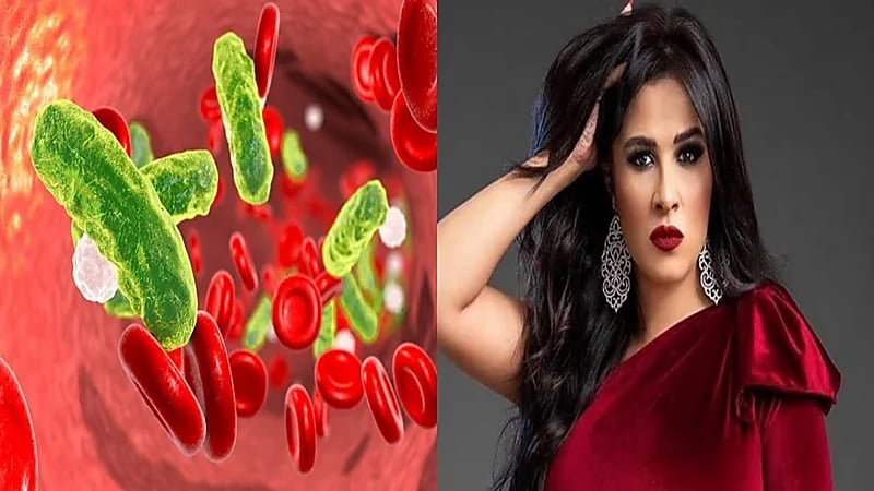 طرق الوقاية من تسمم الدم الذي عانت منه ياسمين عبدالعزيز