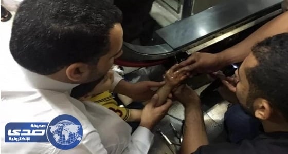 مدني المدينة يحرر يد طفل من سلم كهربائي