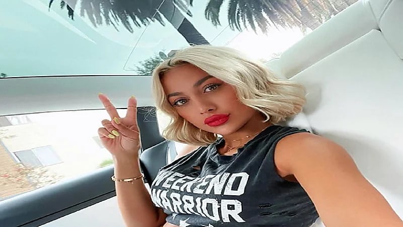 مودل روز تجري عملية تجميل في عينيها