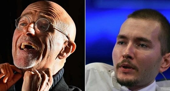 طبيب بريطاني : إعلان نجاح زراعة أول رأس بشري فشل محقق