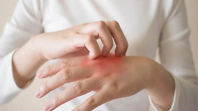 طريقة الوقاية من تورم الأصابع خلال فصل الشتاء