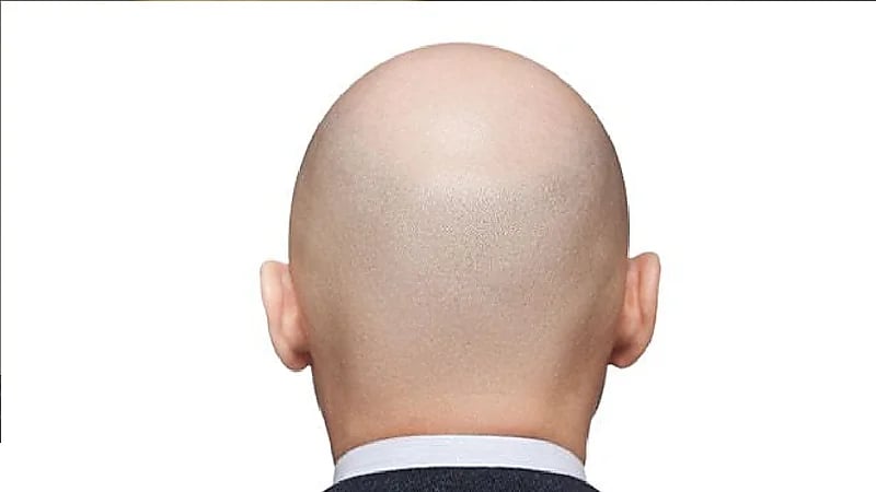 بالفيديو.. قطع رأس رجل أصلع في موزمبيق للاعتقاد بوجود ذهب داخلها