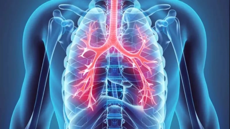 علامة في الإصبع تشير للإصابة بسرطان الرئة