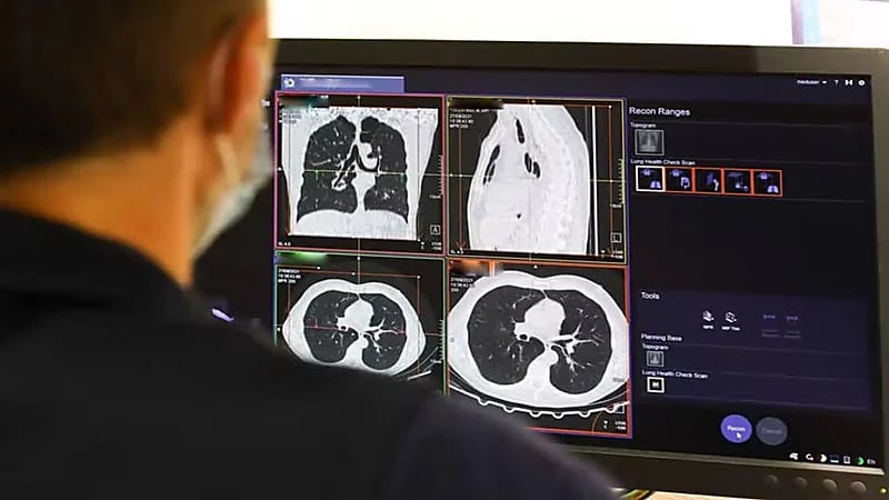 الأرجنتين تسجل ثالث حالة وفاة بسبب مرض رئوي مجهول المصدر