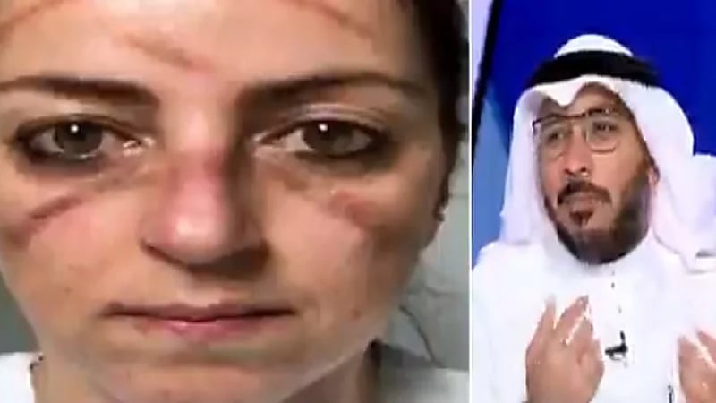 استشاري: الشخص المحصن بجرعتين علميًا غير ملزم بلبس الكمامة