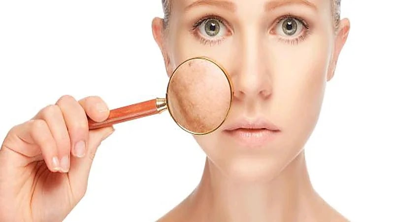 استشارية توجه نصائح مهمة لتقليل تصبغات الجلد في الحمل