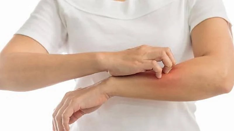 مختص: التوتر قد يتسبب في الحكة والطفح الجلدي