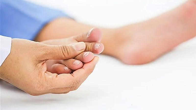 3 أعراض تظهر في القدمين قد تكون علامات تحذيرية لـ "القاتل الصامت "