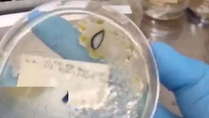 مختص يستعرض كمية الجراثيم والبكتريا في العدسات اللاصقه بسبب النوم بها..فيديو