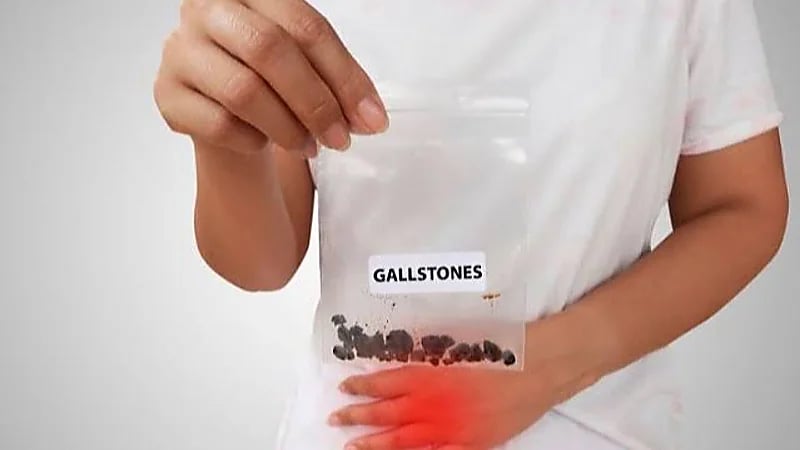 5 علاجات طبيعية فعالة لحصوات الكلى صغيرة الحجم