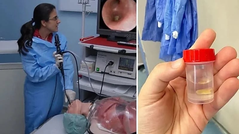 حبة ذرة كادت أن تودي بحياة سيدة