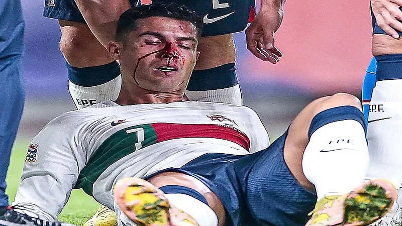 شاهد..رونالدو يتعرض لإصابة قوية بأنفه في مواجهة التشيك