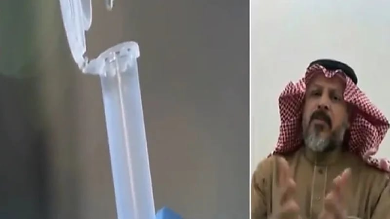 بالفيديو.. استشاري: حينما يتم اكتشاف سرطان القولون متأخرا تكون الوفاة خلال أشهر