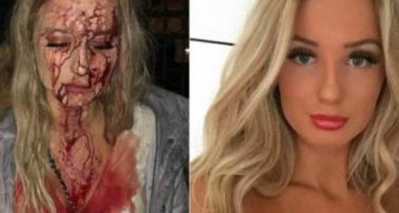 شاب يهشم وجه فتاة حسناء لرفضها التحرش بها