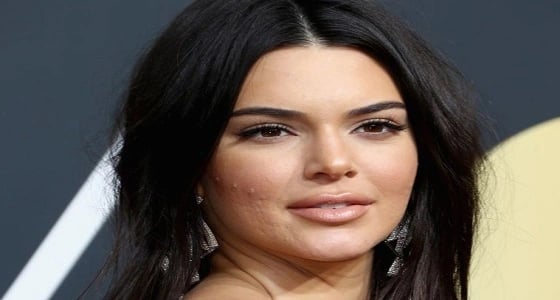 عارضة أزياء شهيرة تثير ضجة ببشرة وجهها السيئة