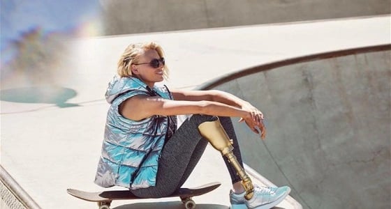 عارضة أزياء تفقد ساقها بسبب الانفلونزا