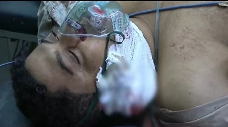 قناص حوثي يستهدف يمنيًا أثناء جلوسة بجوار منزله