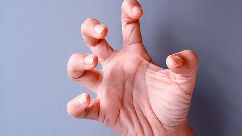 أسباب التشنجات والتقلصات في أصابع اليد