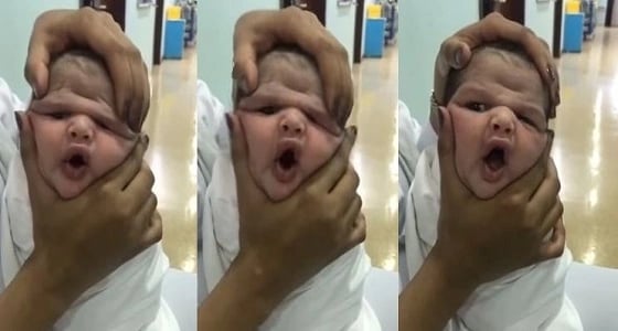 آخر تطورات قضية العبث في رضيع الطائف