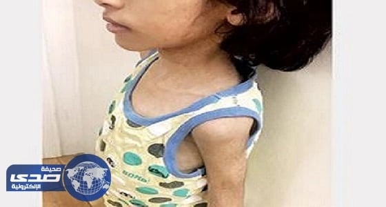 تفاصيل جديدة في واقعة الأطفال المعنفين بمكة