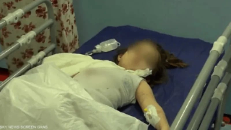 العراق.. دب ينهش ذراع طفلة