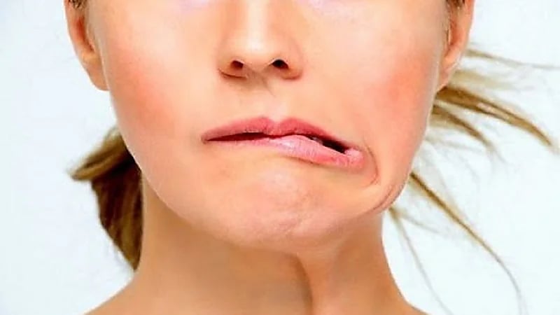 بالفيديو.. استشاري: الحوامل أكثر عرضة للإصابة بالعصب السابع