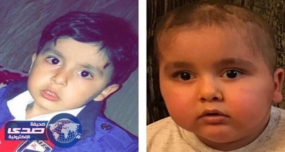 أمر سامٍ بعلاج طفل يعاني فقدان البصر خارج المملكة