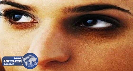 أطعمة تحارب الهالات السوداء