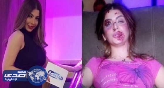 مذيعة تتعرض لحادث أليم اثناء محاولة أثبات قدرة المرأة على القيادة