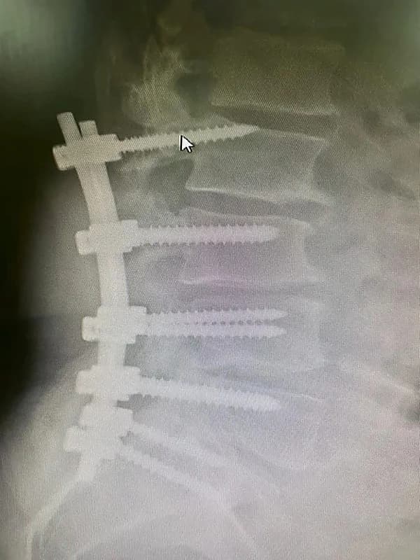 الصحة توضح الفئة الأكثر عرضة لدخول العناية الحرجة "فيديو"