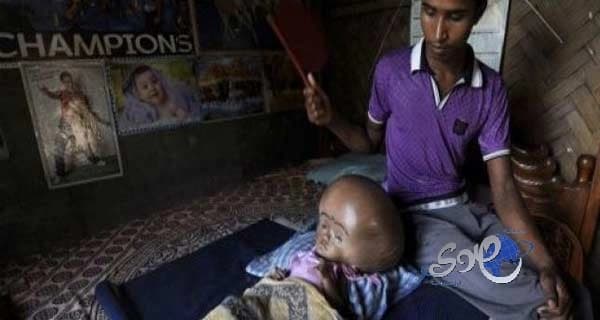 لأول مرة.. إجراء 7 عمليات زراعة كلى تبادلية متزامنة بمستشفى الملك فهد