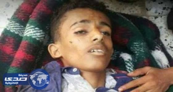 إصابة 150 شخصًا جراء ضباب كيماوي في بريطانيا