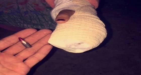 في الخرج: طلقة أفراح طائشة تغتال براءة طفلة ذات الأربعة أعوام