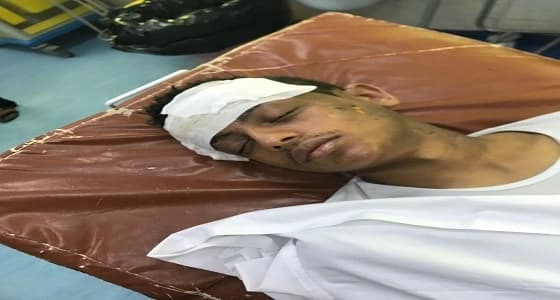 إصابة 4 أشخاص إثر انفجار " معطر جو " في ضمد