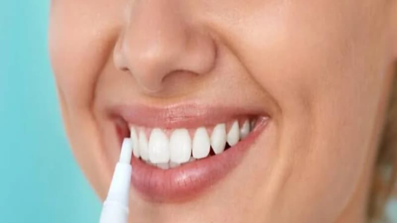 طرق طبيعية لتبييض الأسنان قبل الزفاف