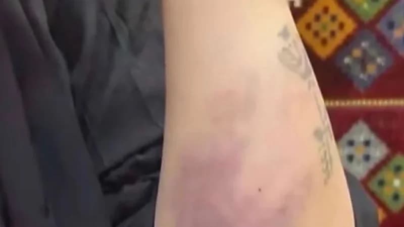 "العنف الأسري" يباشر الواقعة المتداولة حول تعرُّض امرأة للتعنيف