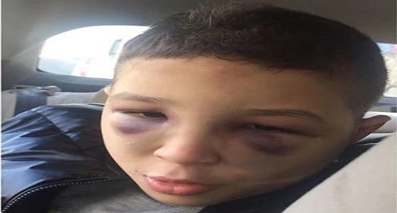 سفارة المملكة بالأردن تتفاعل مع شكوى مواطن بتعرض ابنه للتعذيب