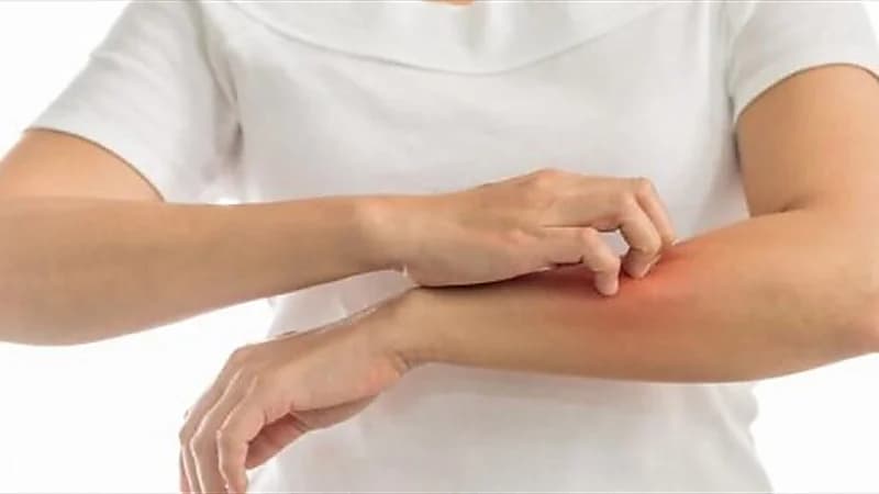 ارتباط أمراض الجلد بمشكلات الصحة العقلية