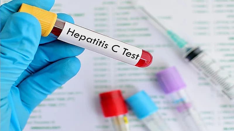 استشاري يوضح أسباب الإصابة بفيروس "سي" وطرق الوقاية منه