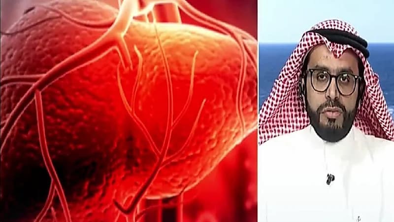 استشاري: التهاب الكبد يصيب الأطفال الذين متوسط أعمارهم من سنتين إلى 5 سنوات (فيديو)
