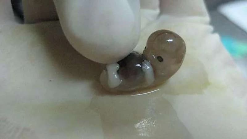 الأردن.. العثور على جثة جنين داخل "مرطبان"بالشارع