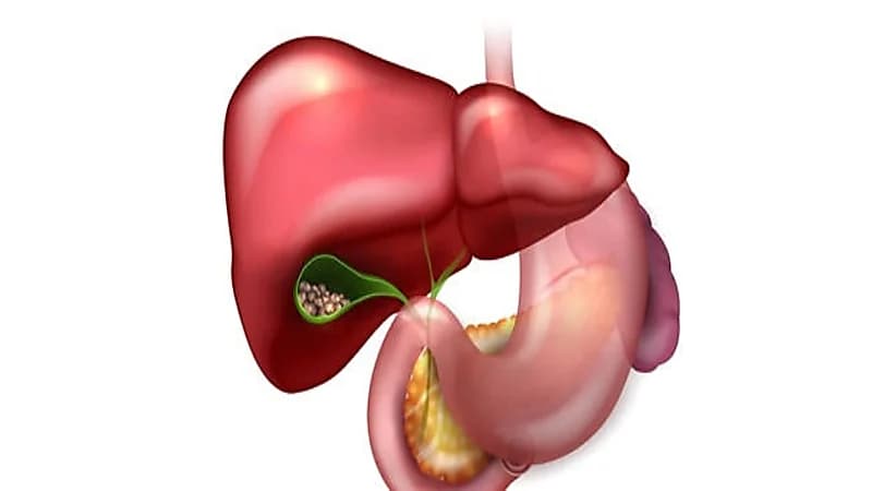 استشاري يكشف عن أماكن الشعور بألم المرارة