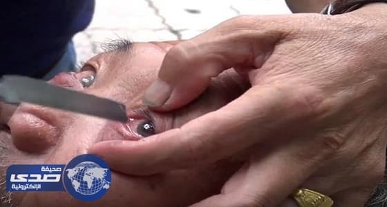 بالفيديو.. حلاق ينظف عيون الزبائن بـ " السكين "