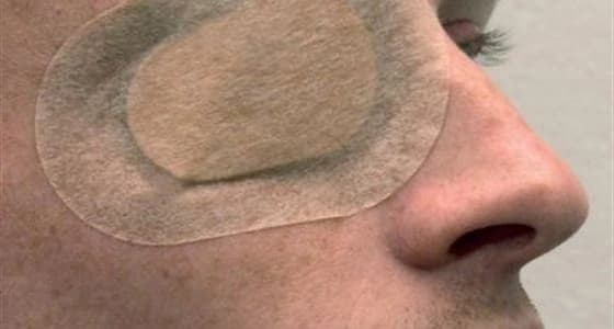 شاب يفقد بصره مدى الحياة عقب معاكسته فتاة في الشارع