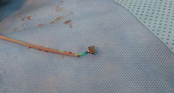 رصاصة تستقر في قلب طفل لأكثر من 24 ساعة بالمدينة